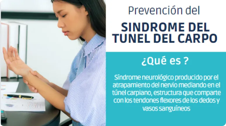 Sindrome del tunel carpo